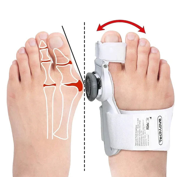 Corrector Ajustable de Juanetes FootAligner™