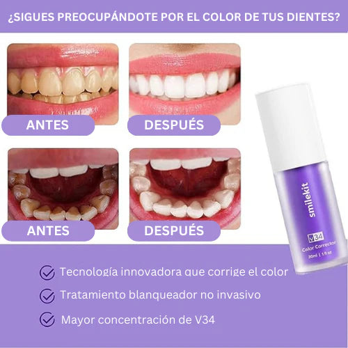 Blanqueador Dental SERUM 10™